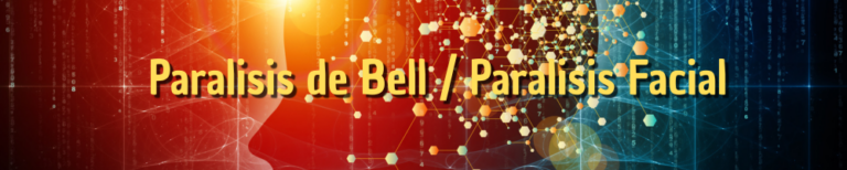 Mi paralisis de Bell