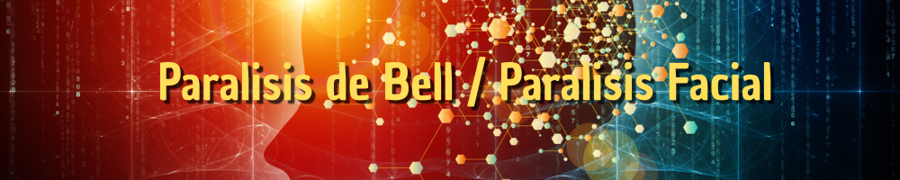 Mi paralisis de Bell